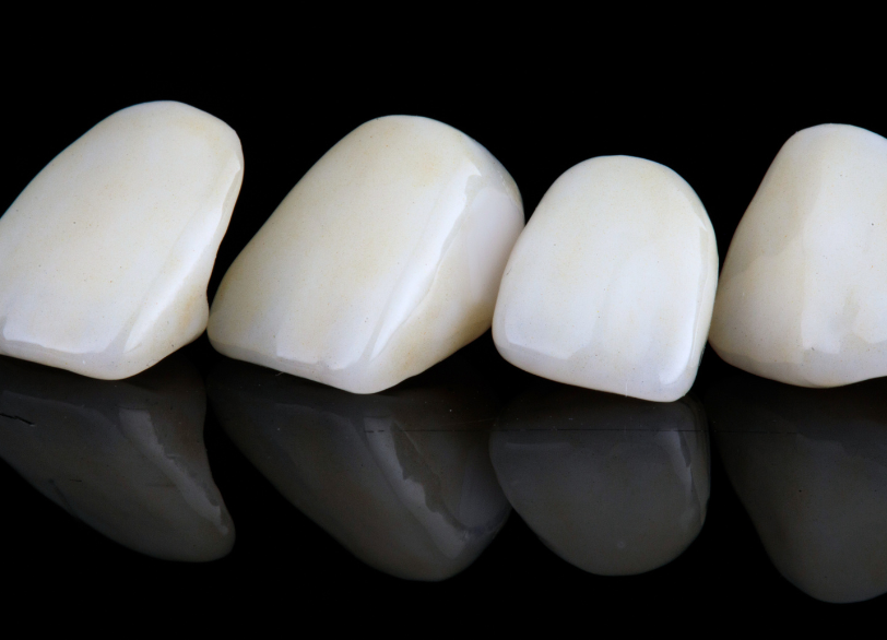 オールセラミッククラウン｜小野歯科