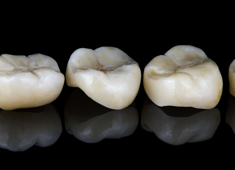 ジルコニアクラウン|小野歯科