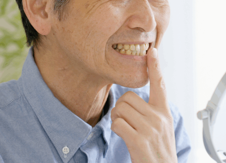 もう一度自分の歯で、思いっきり噛みたい|小野歯科