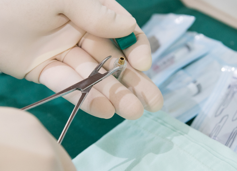 小野歯科医院の精密インプラント治療|小野歯科