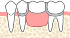 入れ歯|小野歯科