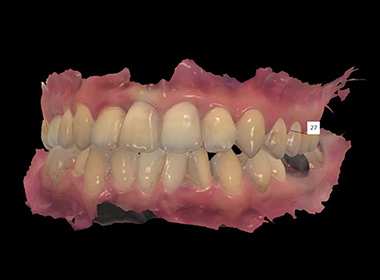 スキャン|小野歯科