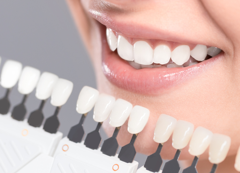 トップ８ホワイトニング｜小野歯科