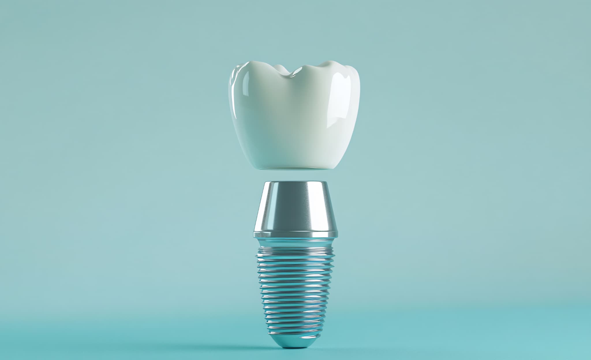 インプラントのイメージ