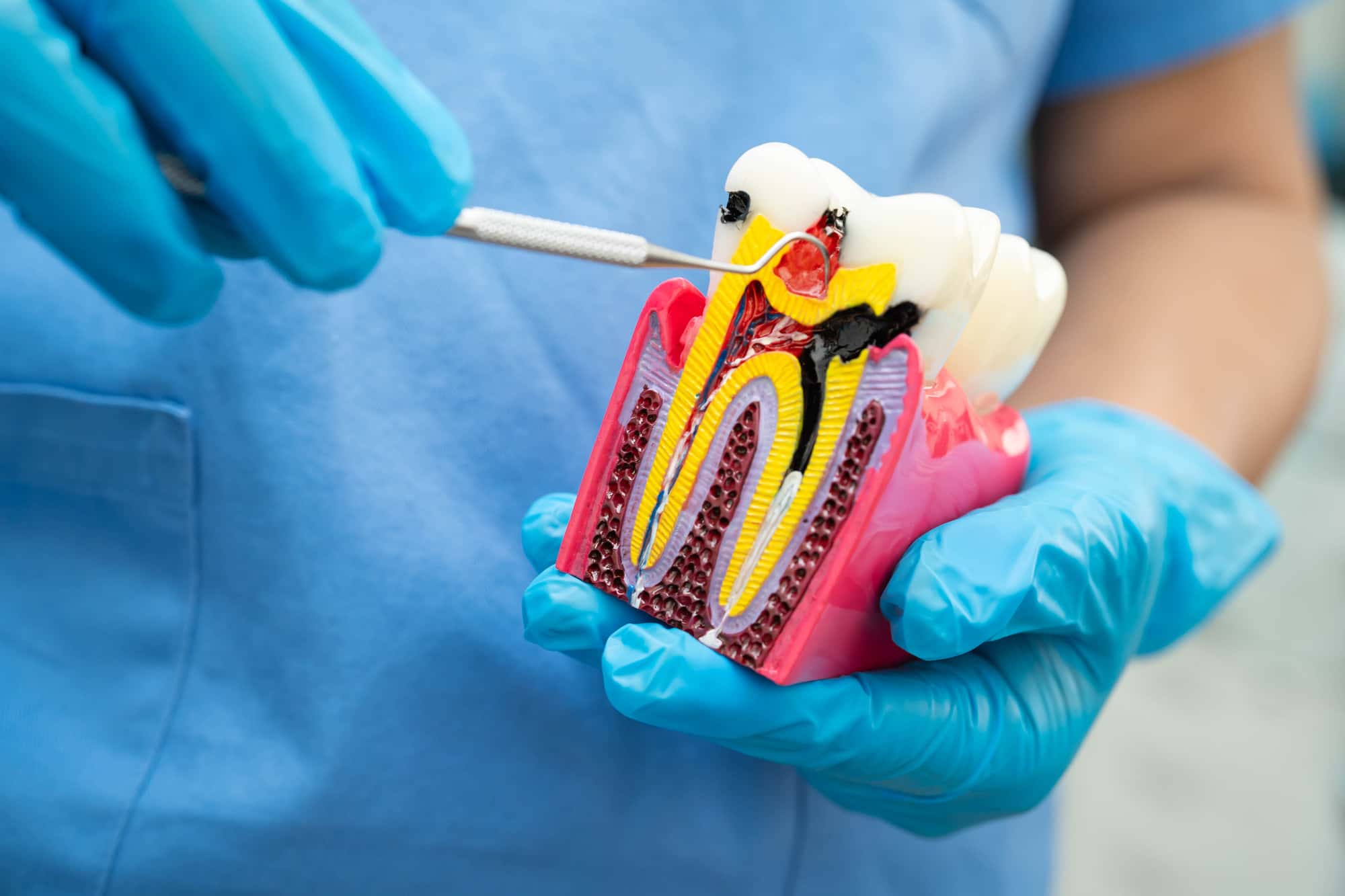 根管治療について説明する歯科医