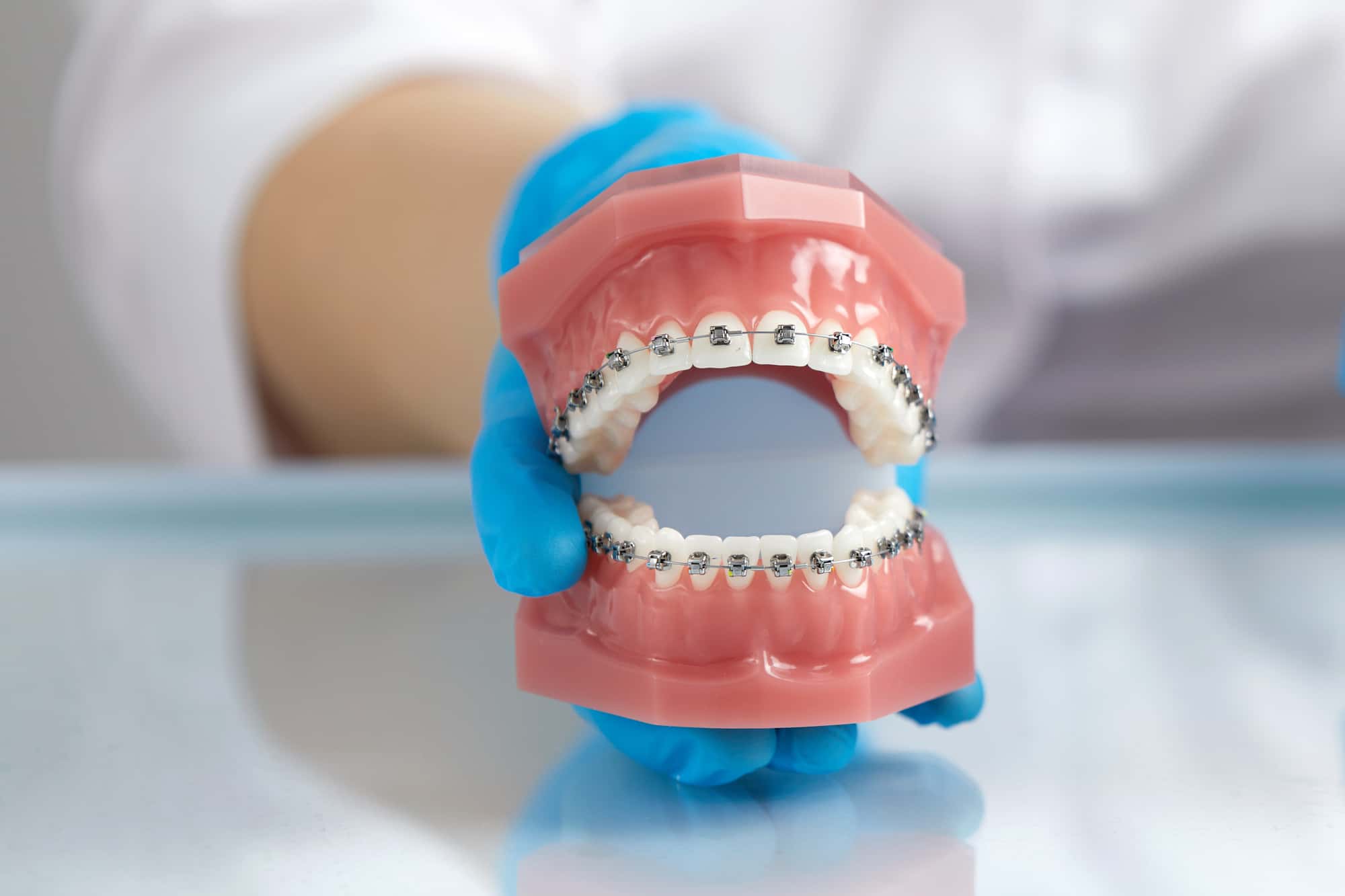 歯科医がワイヤー矯正について説明するイメージ