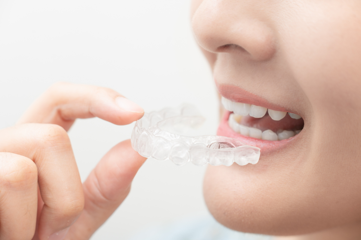 マウスピース矯正をしている女性