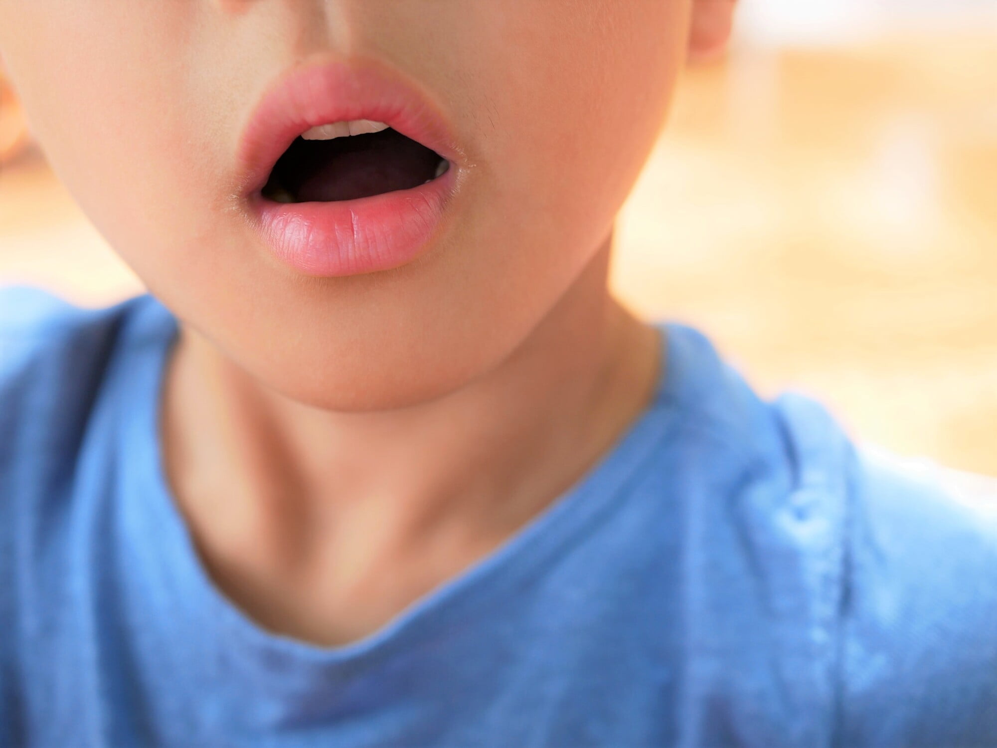 口呼吸をしている子どもの口元
